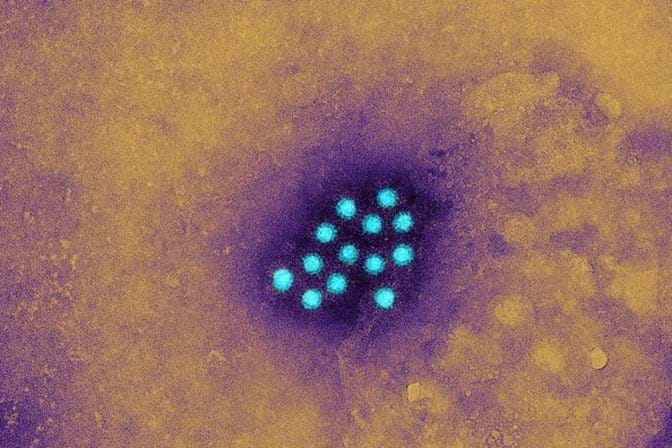 Subiu para 108 o número de casos notificados de hepatite A