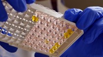 Confirmados 322 casos de hepatite A desde o início do ano