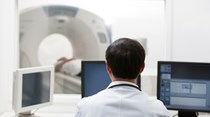 Tratamento de radioterapia deve ser personalizado