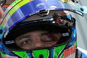 Felipe Massa ainda em coma