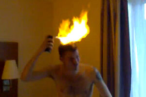 Jovem pega fogo ao próprio cabelo