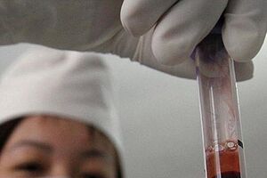 Sida: Terá sido descoberta a cura?