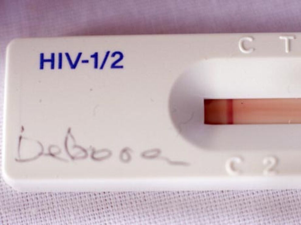 Médicos revelam primeiro caso de cura de bebé infectado com sida