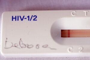 Médicos revelam primeiro caso de cura de bebé infectado com sida