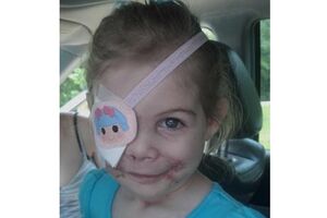 KFC 'expulsa' menina atacada por pitbull por assustar clientes