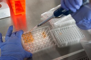 Financiamento de 3,4 milhões para estudo do diagnóstico precoce do cancro