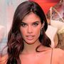 Sara Sampaio tem os melhores lábios do mundo