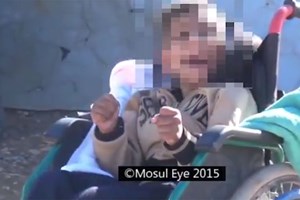 Daesh dá ordem para matar bebés com Síndrome de Down e não só