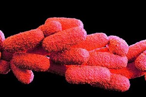 Identificado homem infectado com legionella na ilha do Pico