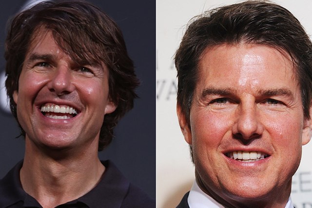 O ator de Hollywood Tom Cruise ainda tem o rosto inchado pelo que