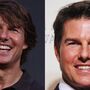 O que é que Tom Cruise fez à cara?