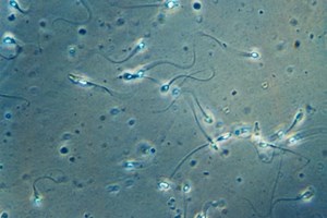 Associação de Fertilidade pede aprovação urgente de projectos para alterar lei da PMA