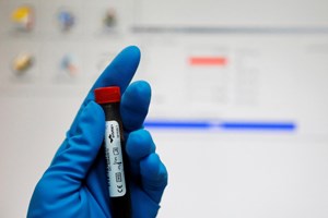 Agência antidopagem russa espera exclusão do país dos Jogos Olímpicos