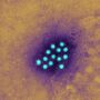 Nova hepatite infantil desconhecida chega a Espanha