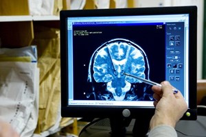 Estudo de dois anos realizado em Gaia identificou nove biomarcadores da dor