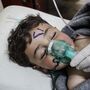 Análises às vítimas provam uso de gás sarin em Idlib