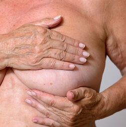 Uma em cada quatro mulheres sabe pouco sobre risco de cancro da mama voltar