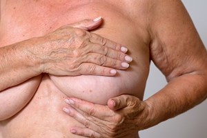 Infarmed aprova novo tratamento para o cancro da mama