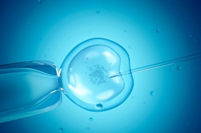 O processo completo dura à volta de 40 dias