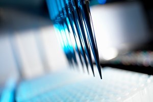 Chave para cura de madeirense com cancro raro pode estar no Reino Unido