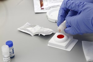 Quatro crianças infetadas com VIH em 2020 e 2021 
