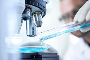 Cientistas revelam mecanismo que aumenta agressividade de células tumorais no estômago