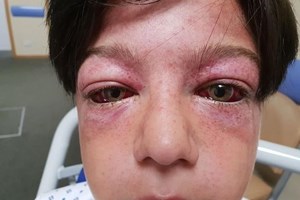 Desafio em parque infantil leva menino à beira da morte