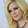 Avril Lavigne vence doença: 'Tinha aceitado a minha morte'