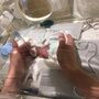 Ele tornou-se no bebé mais pequeno do mundo a ter sobrevivido
