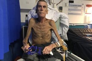 Morreu o homem que com 38 quilogramas foi dado como apto a trabalhar