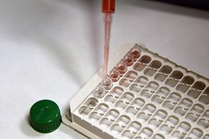 Liga Contra a Sida pede apoios para comprar unidade móvel para rastreios