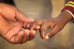Criança guineense com 4 anos e 39 quilos corre risco de vida se não for tratada no estrangeiro