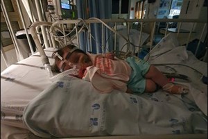 Bebé Matilde vai ser operada à cabeça esta sexta-feira