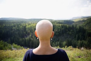 Covid-19: Associações de doentes pedem acesso de todos aos cuidados de saúde