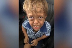 O mundo juntou-se para apoiar Quaden, vítima de bullying