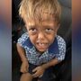 O mundo juntou-se para apoiar Quaden, vítima de bullying