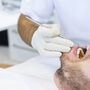Sabia que o dentista pode ajudar a prevenir o enfarte e o AVC?