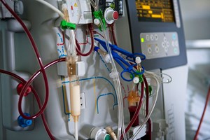 Covid-19: Sociedade pede urgência na vacina e testagem maciça de doentes em hemodiálise