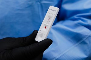 Covid-19: Consórcio de investigação lança projeto de ensaio serológico em Portugal
