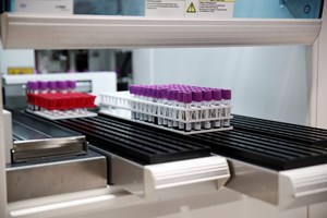 Covid-19: Portugal envia aparelho de testes para província angolana da Huíla