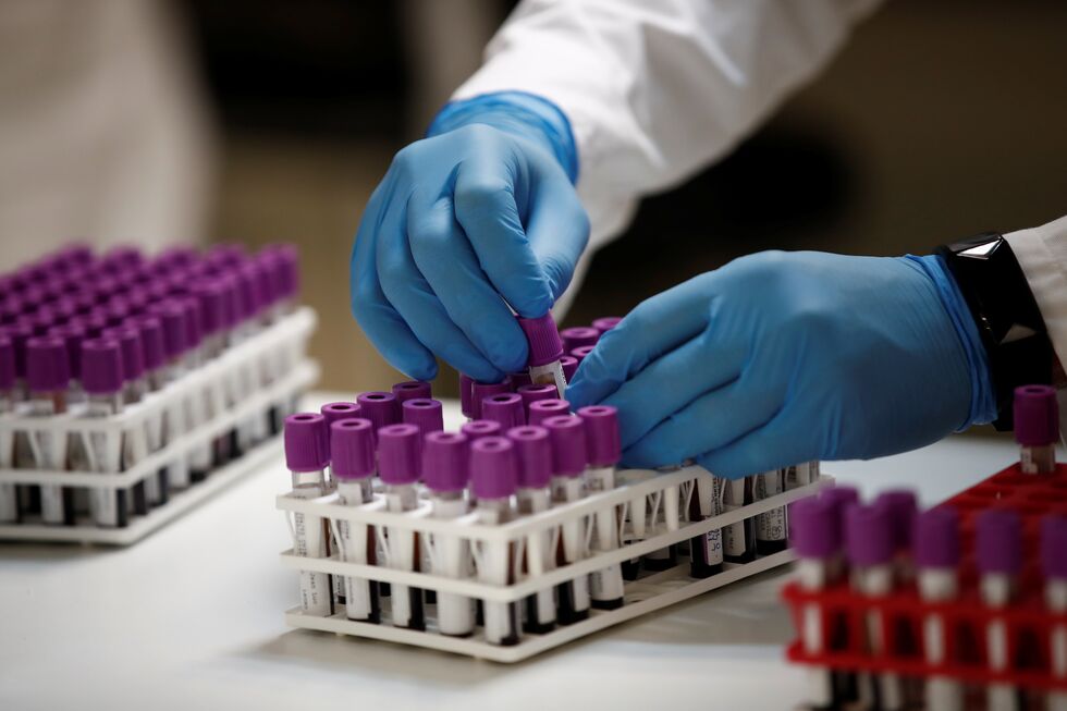 Testes serológicos Covid-19