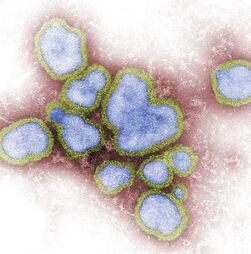 Investigadores portugueses testam forma de bloquear o vírus da gripe A antes da infeção