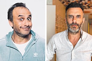 Implantes capilares: já é difícil encontrar um careca famoso