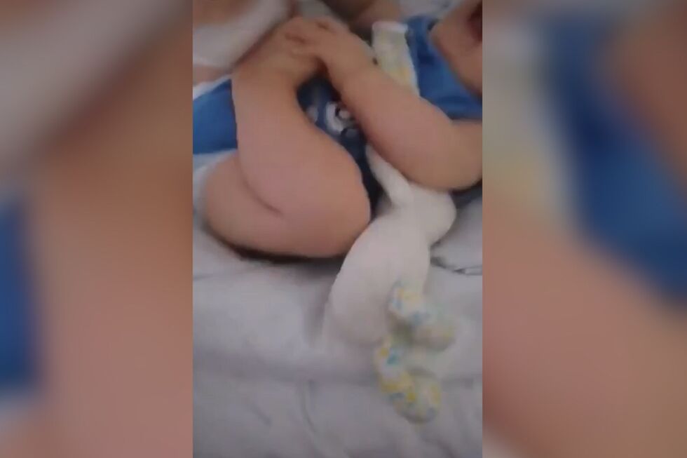 As primeiras de imagens de Rodrigo, o bebé sem rosto, antes de entrar no bloco operatório