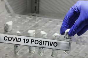 covid, coronavírus, doente, paciente