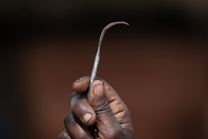 Mutilação genital feminina: hospital identificou 59 mulheres no ano passado