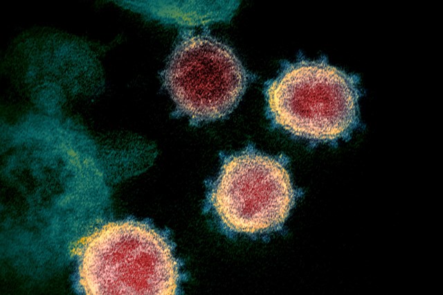 Covid-19: Infecciologista do Santo António alerta para 'perigo' das variantes