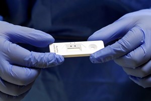 Covid-19: Testes rápidos de antigénio registaram maior número de sempre a 07 de abril