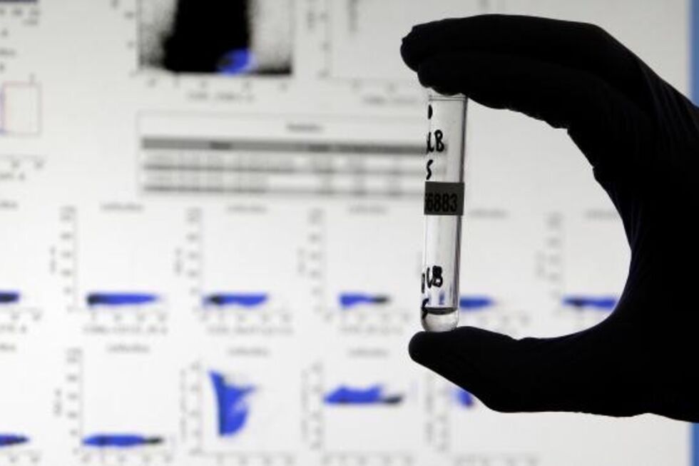 Novo teste à covid-19 em Espanha deteta anticorpos até hoje invisíveis