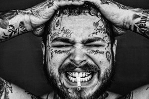 Post Malone tem dentes de diamante